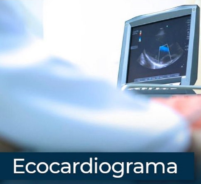 ecocardiograma.jpg