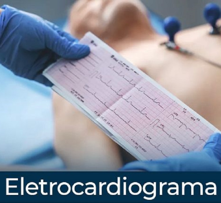 eletrocardiograma.jpg